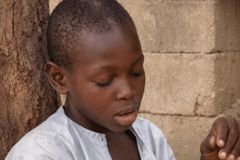 A Story That Shouldn’t Be Ignored: Why This Little Boy Needs Us Today(Aminu Story)