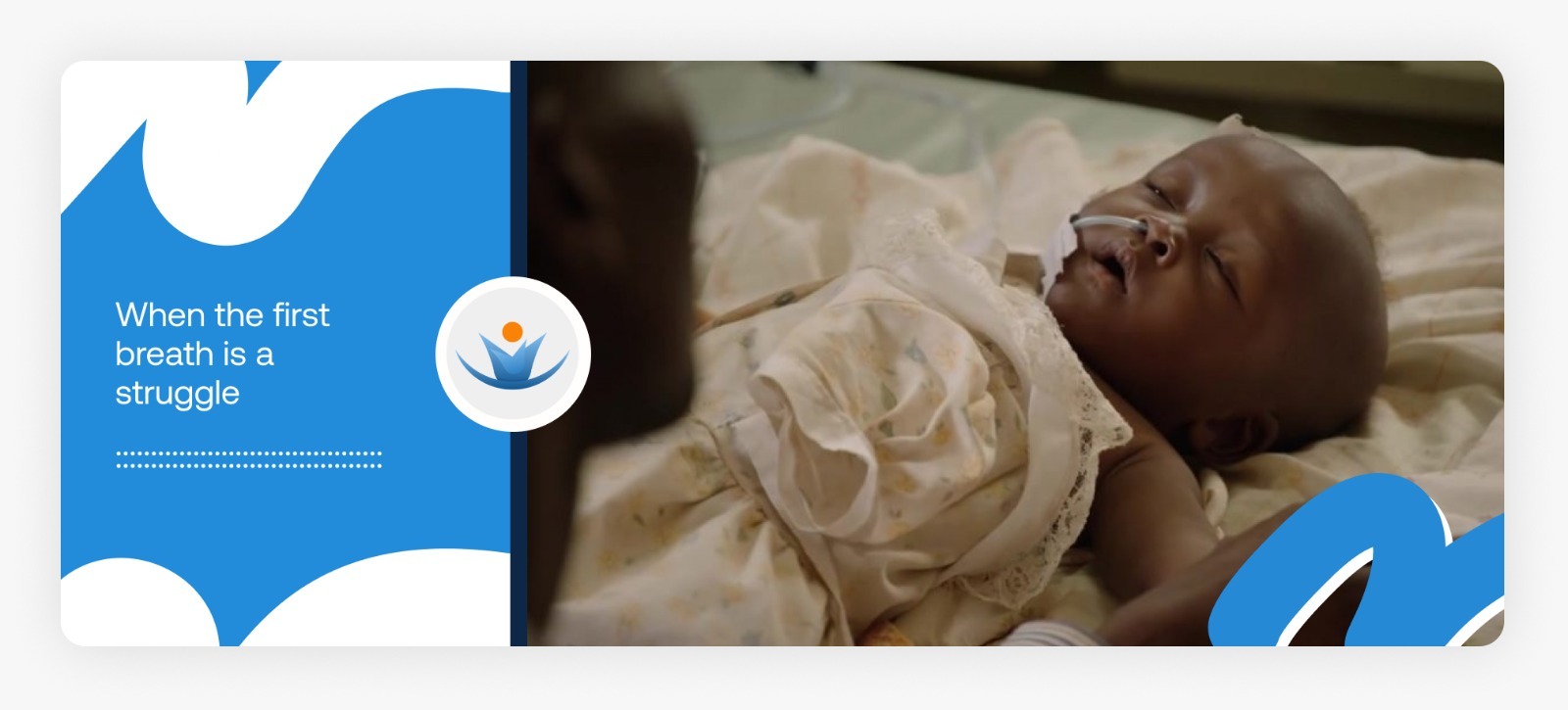 A tiny newborn baby in a hospital bed breathing through a respiratory pipe, demonstrating the urgent need for support for dying babies in Africa in 2026.